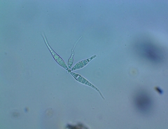 Flabellospora acuminata