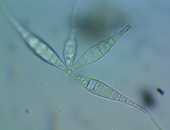 Flabellospora acuminata