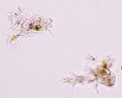 Amoebidae