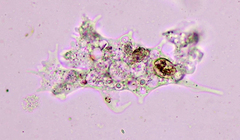 Amoebidae