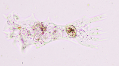 Amoebidae
