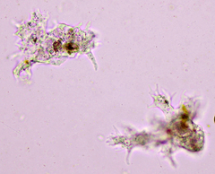 Amoebidae