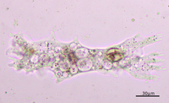 Amoebidae