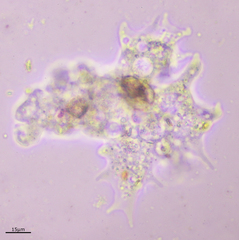 Amoebidae