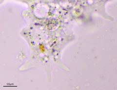 Amoebidae