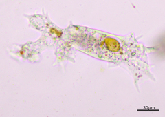 Amoebidae