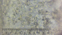 Trechispora hymenocystis