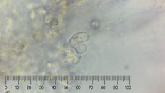 Trechispora hymenocystis