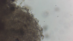 Trechispora hymenocystis