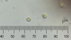 Trechispora hymenocystis