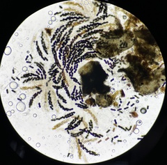 Delitschia chodocola