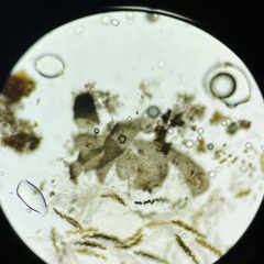 Delitschia chodocola