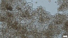 Lycoperdon