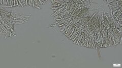 Pezizomycotina