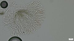 Pezizomycotina