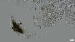 Pezizomycotina