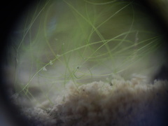 Ostracoda
