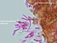 Pseudocercospora