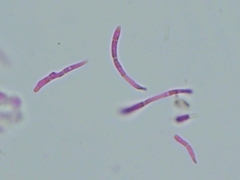 Pseudocercospora