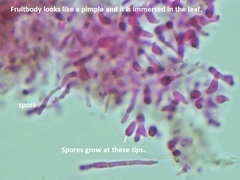 Pseudocercospora