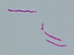 Pseudocercospora