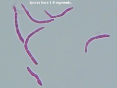 Pseudocercospora