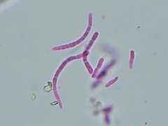 Pseudocercospora