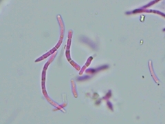 Pseudocercospora