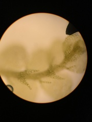 Lejeunea trinitensis