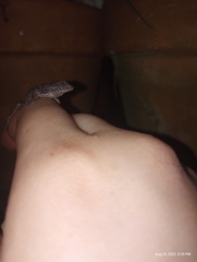 Sceloporus undulatus