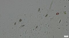 Nectriaceae