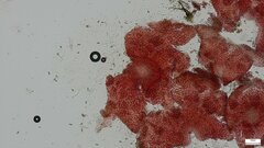 Nectriaceae