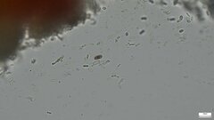 Nectriaceae