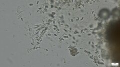 Nectriaceae