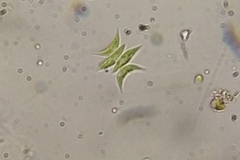 Tetradesmus