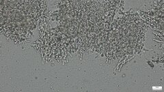 Basidiomycota