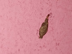 Phereoeca