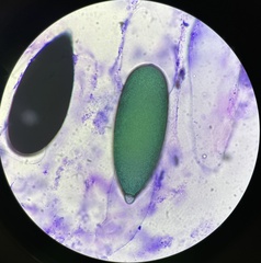 Podospora gigantea