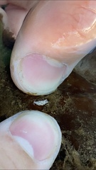 Trinchesia albocrusta