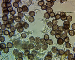 Didymium squamulosum