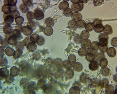 Didymium squamulosum