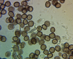 Didymium squamulosum