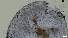 Pezizomycotina