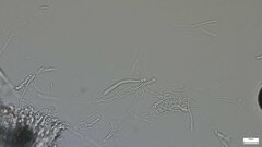 Pezizomycotina