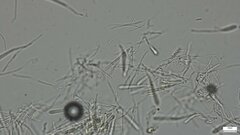 Pezizomycotina