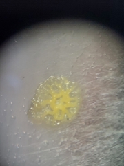 Bacteria