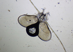 Ostracoda