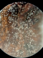 Botrytis