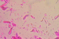 Marasmiellus subnigricans