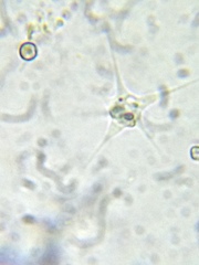 Amoebozoa